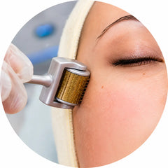 Derma Roller At-Home Treatment